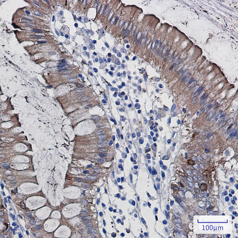 SCIN Rabbit mAb ABZ1709