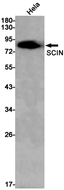 SCIN Rabbit mAb ABZ1709
