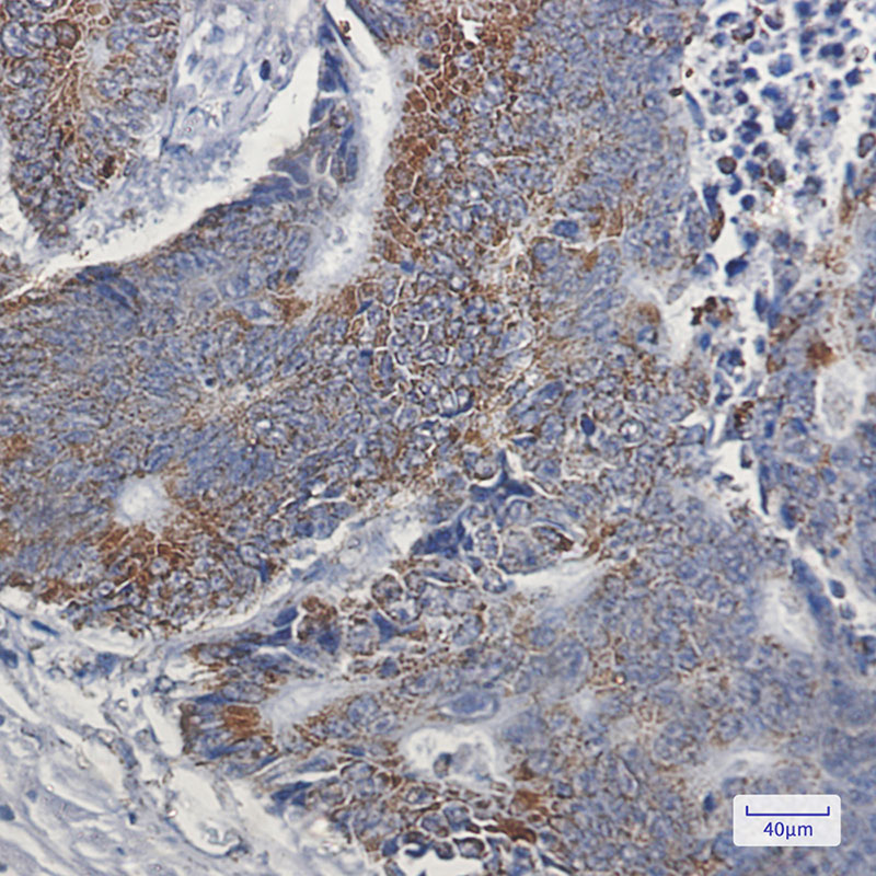 NDUFB9 Rabbit mAb ABZ1710