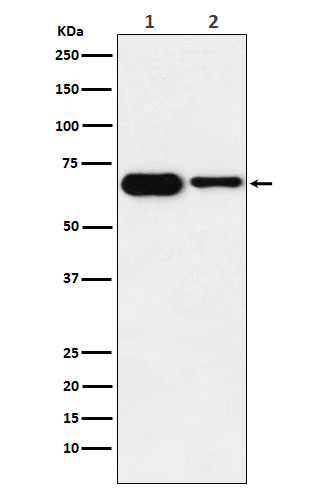 IGF2BP2 Rabbit mAb ABZ1711