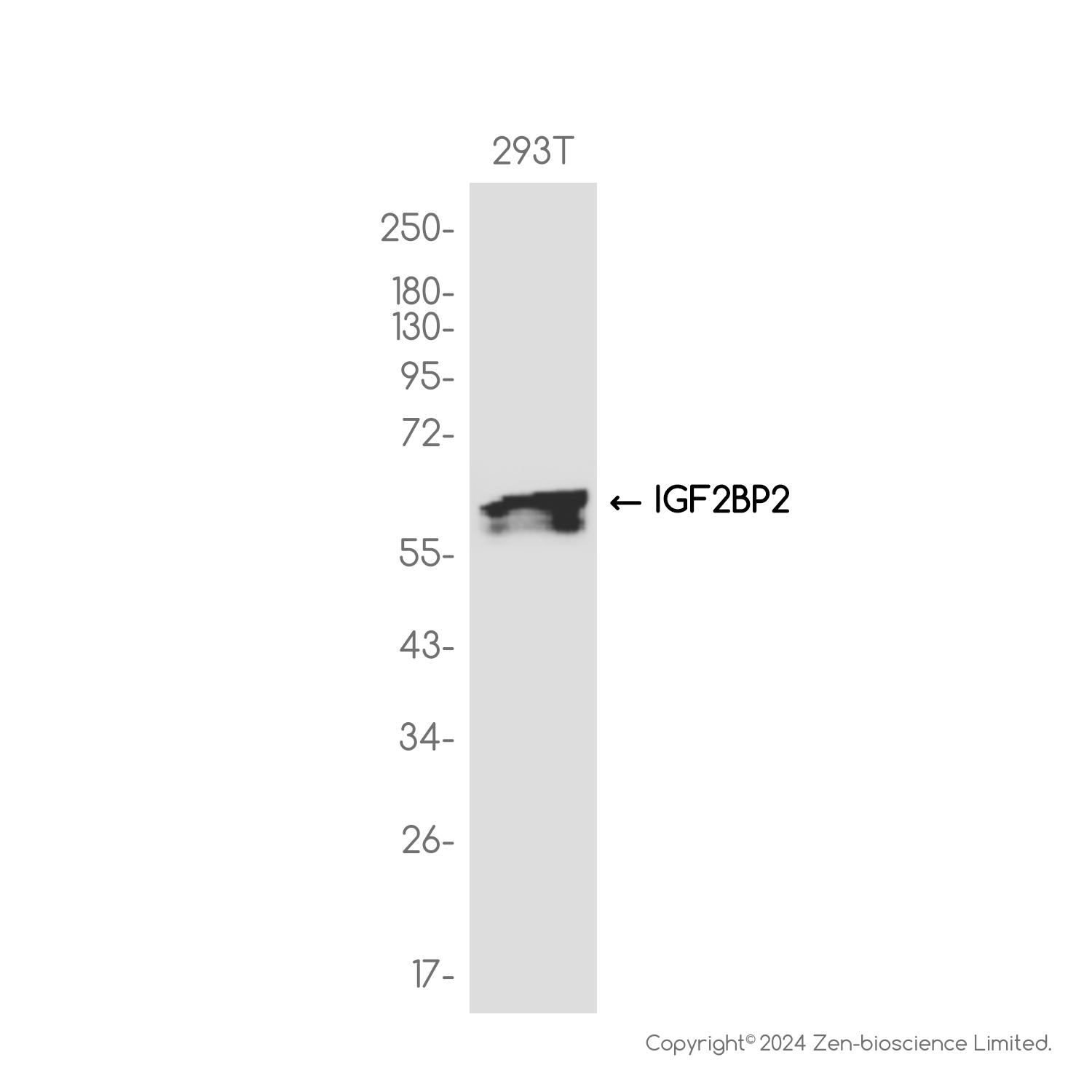 IGF2BP2 Rabbit mAb ABZ1711