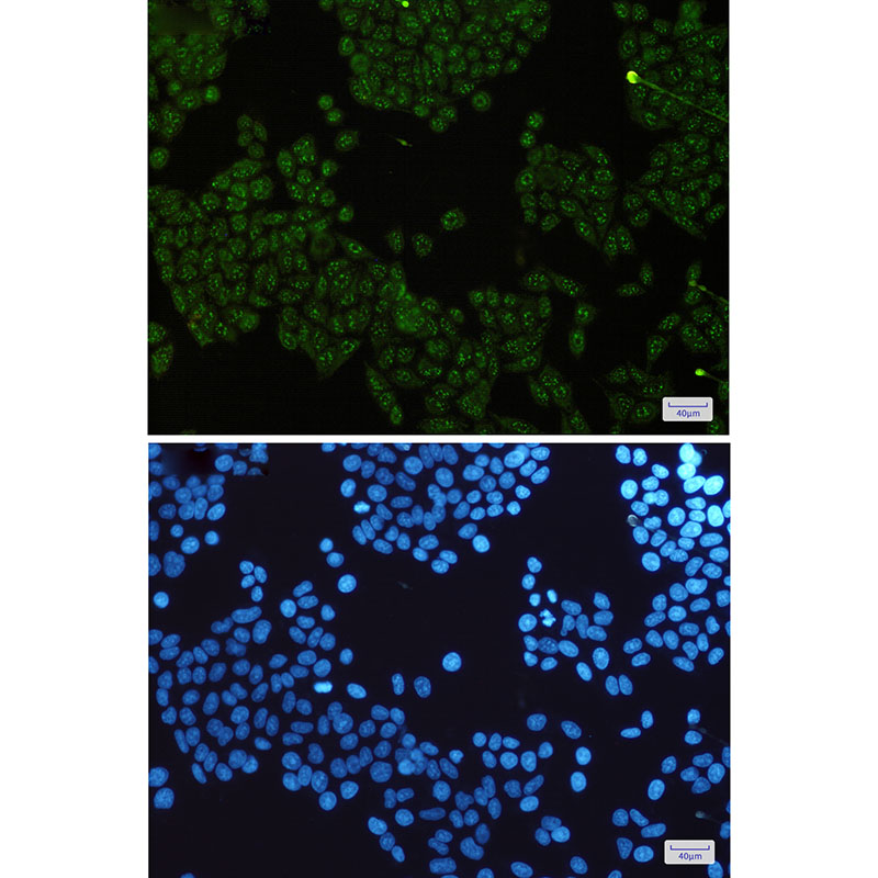 IKK gamma Rabbit mAb ABZ1712