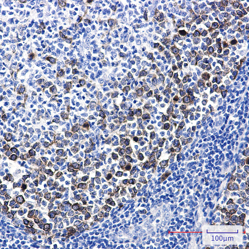 TACC3 Rabbit mAb ABZ1715