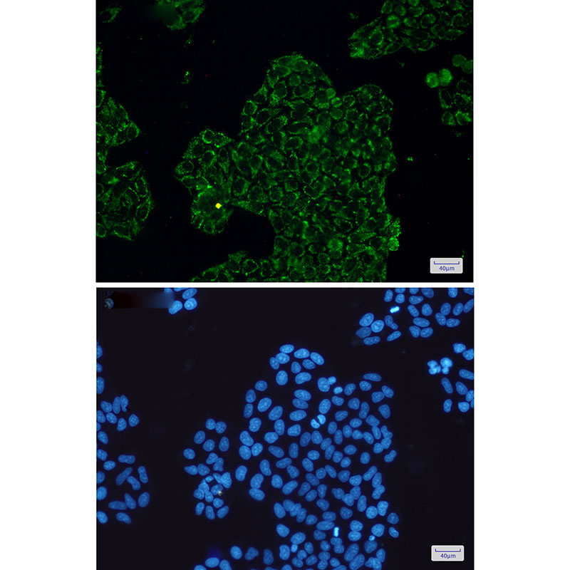 CLIC4 Rabbit mAb ABZ1716