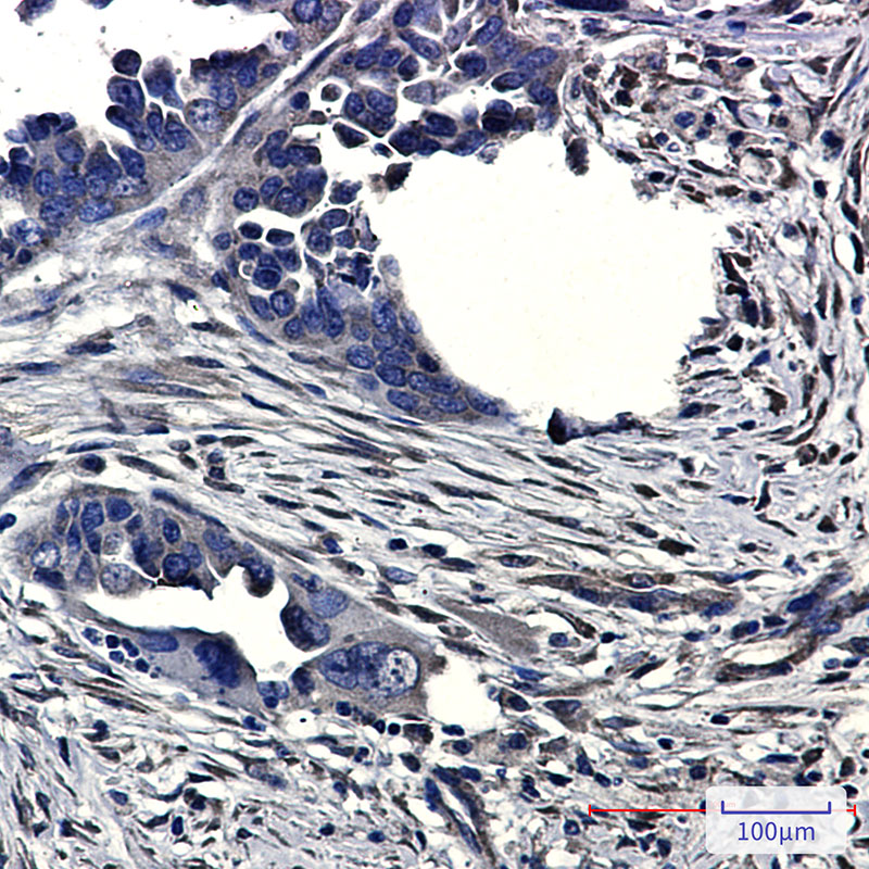 CLIC4 Rabbit mAb ABZ1716
