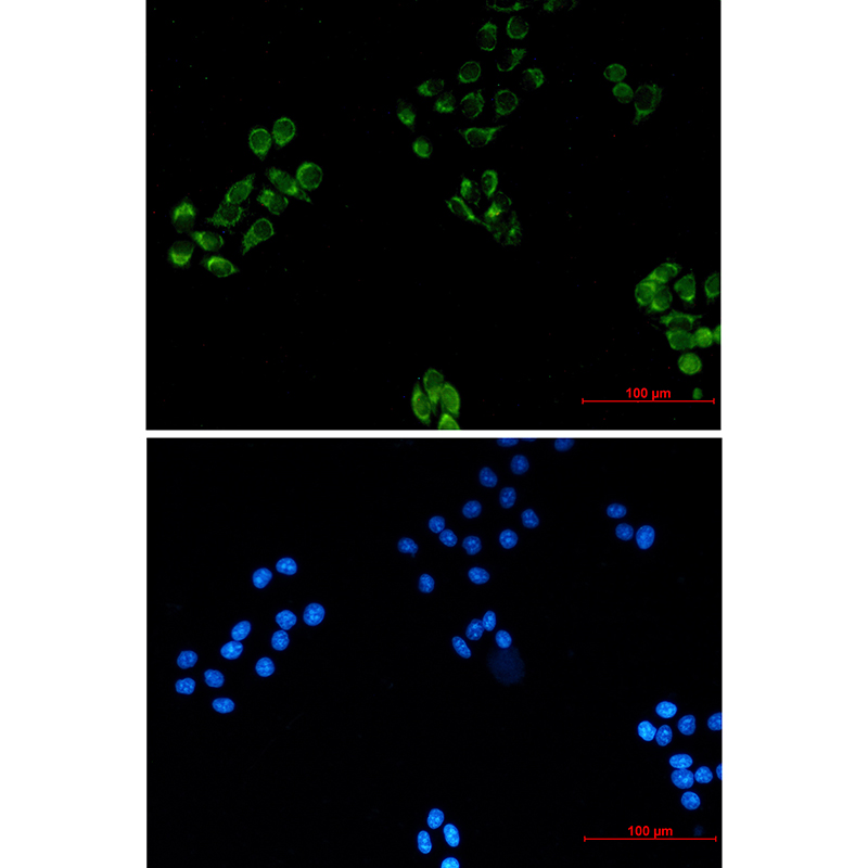 MRPS18B Rabbit mAb ABZ1717