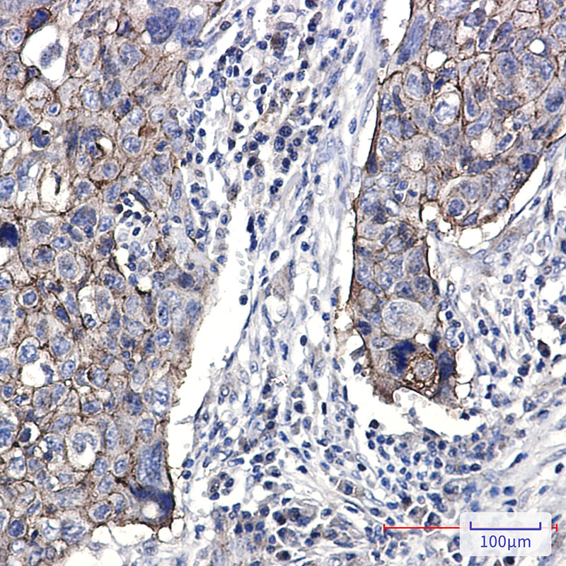 Junctional Adhesion Molecule 1/JAM-A Rabbit mAb ABZ1718