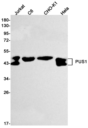PUS1 Rabbit mAb ABZ1720