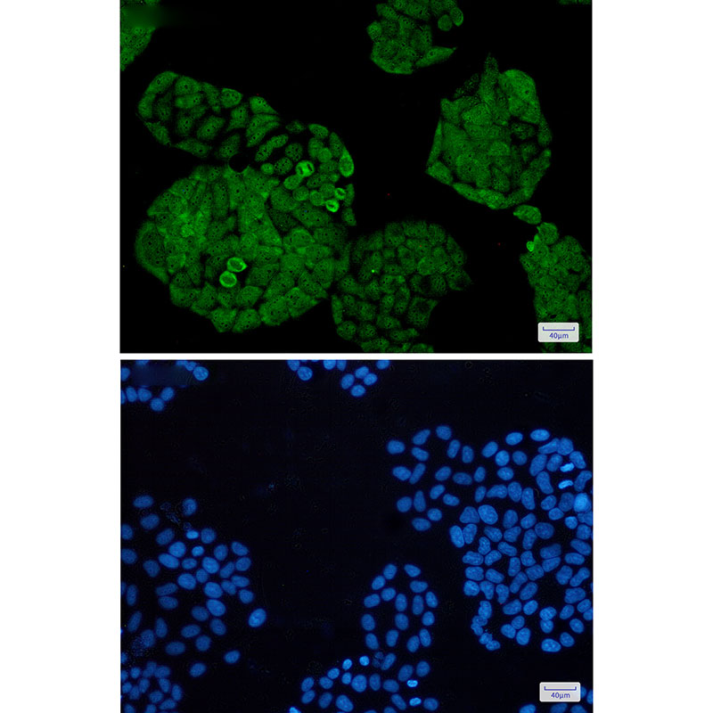 UCHL5 Rabbit mAb ABZ1722