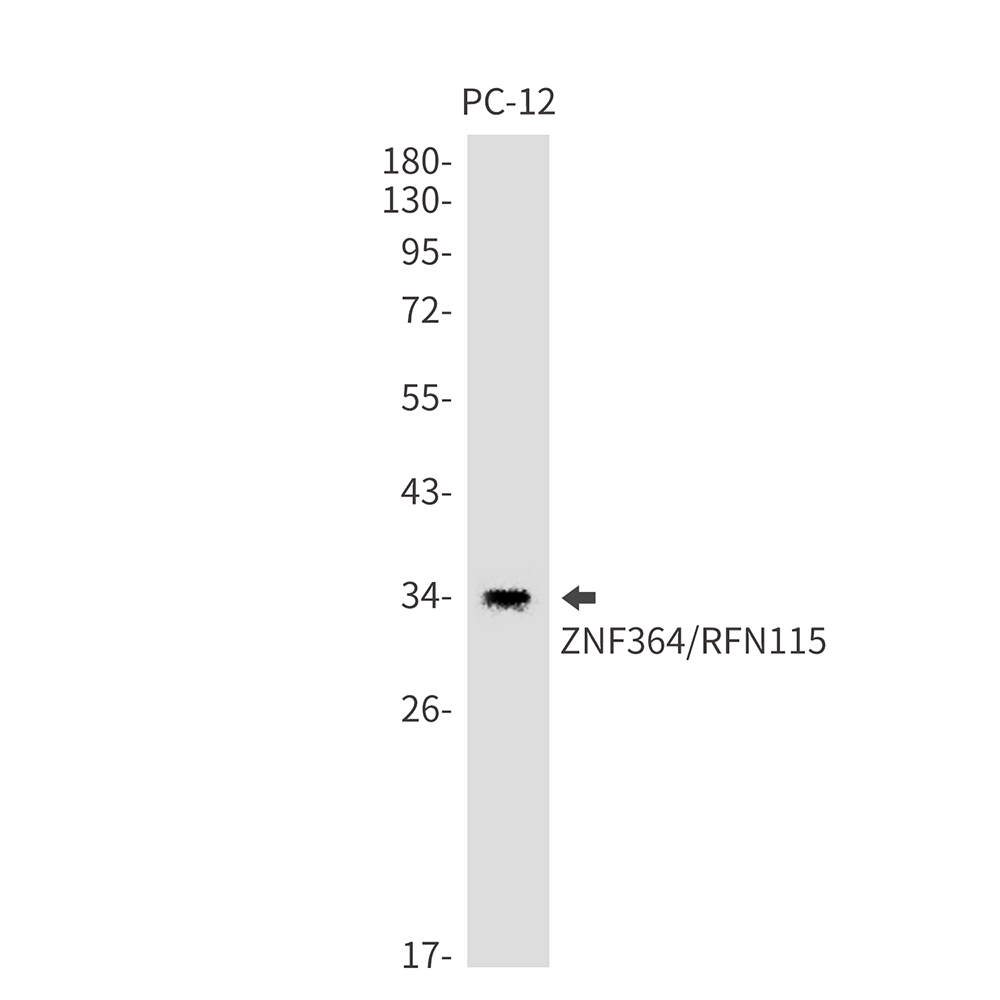 RNF115 Rabbit mAb ABZ1723
