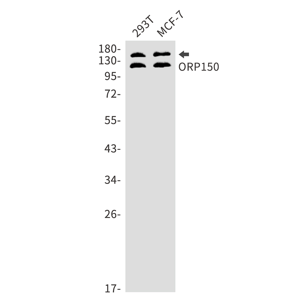 ORP150 Rabbit mAb ABZ1724