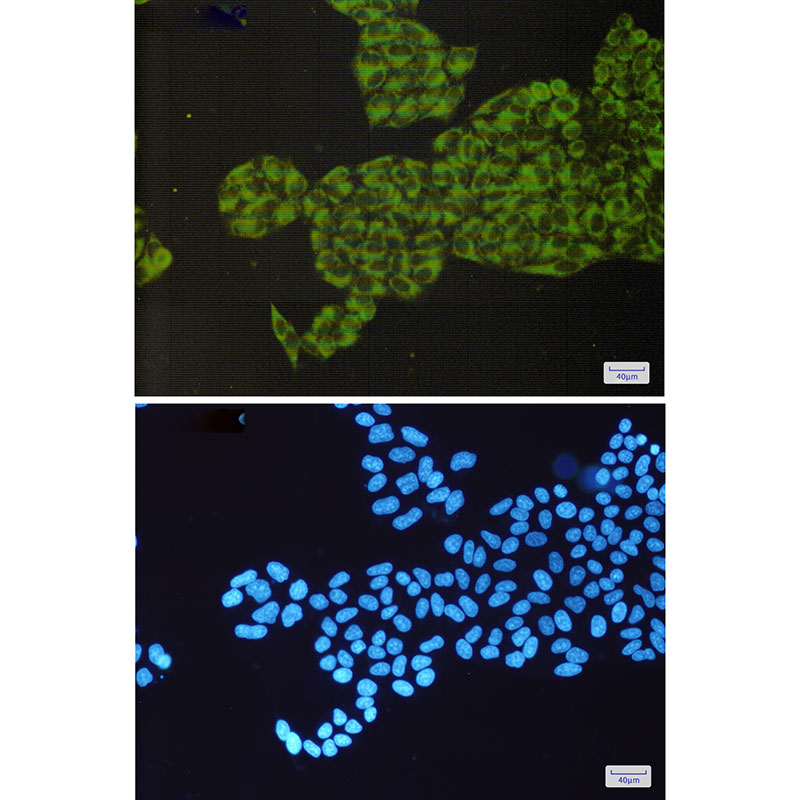 ORP150 Rabbit mAb ABZ1725