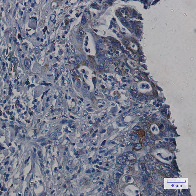 ORP150 Rabbit mAb ABZ1725