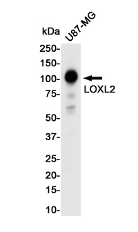 LOXL2 Rabbit mAb ABZ1728