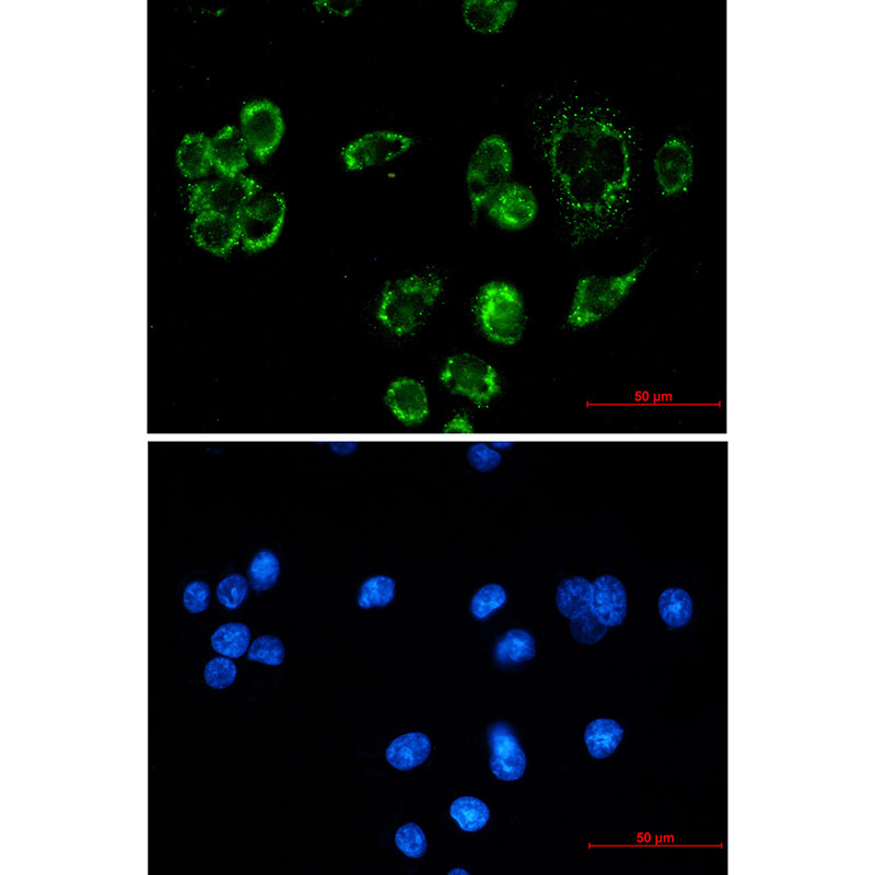 TTC11/FIS1 Protein Rabbit mAb ABZ1729
