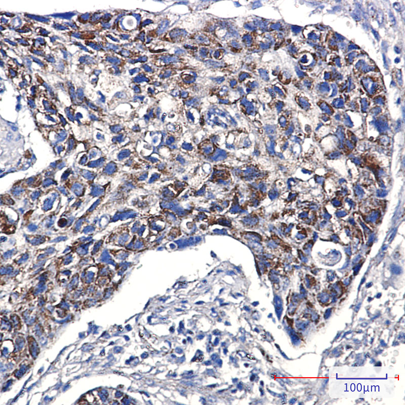 TTC11/FIS1 Protein Rabbit mAb ABZ1729