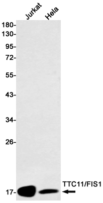 TTC11/FIS1 Protein Rabbit mAb ABZ1729