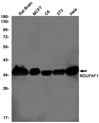 NDUFAF1 Rabbit mAb ABZ1734