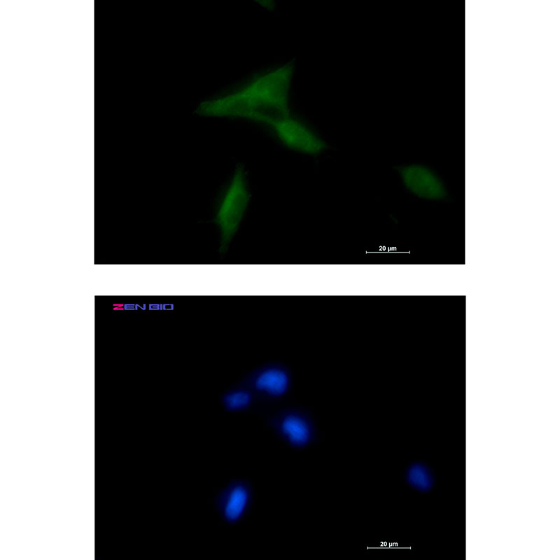 NDUFAF1 Rabbit mAb ABZ1735