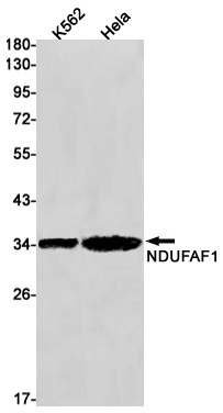 NDUFAF1 Rabbit mAb ABZ1735