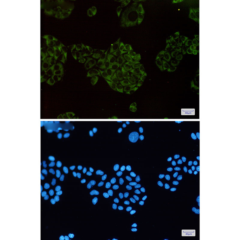 MEKK2 Rabbit mAb ABZ1737