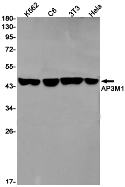 AP3M1 Rabbit mAb ABZ1738