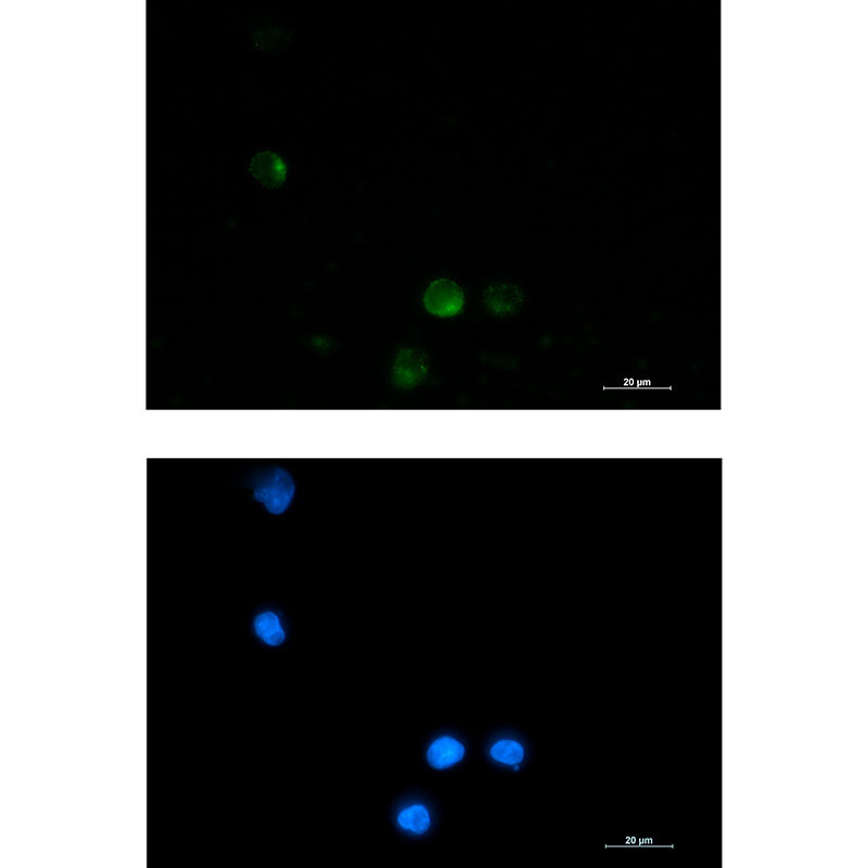 SSX2IP Rabbit mAb ABZ1740