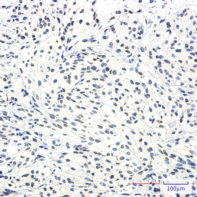 SSX2IP Rabbit mAb ABZ1740