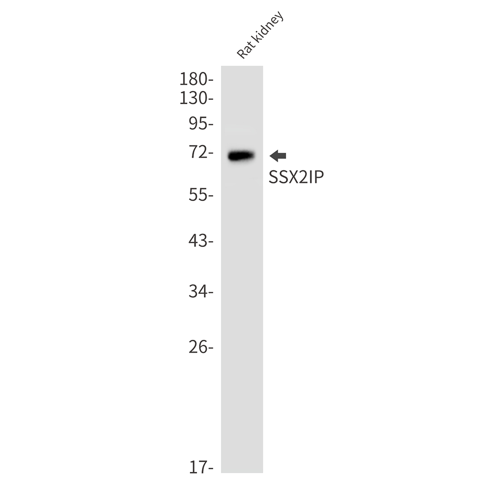 SSX2IP Rabbit mAb ABZ1740