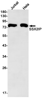 SSX2IP Rabbit mAb ABZ1740