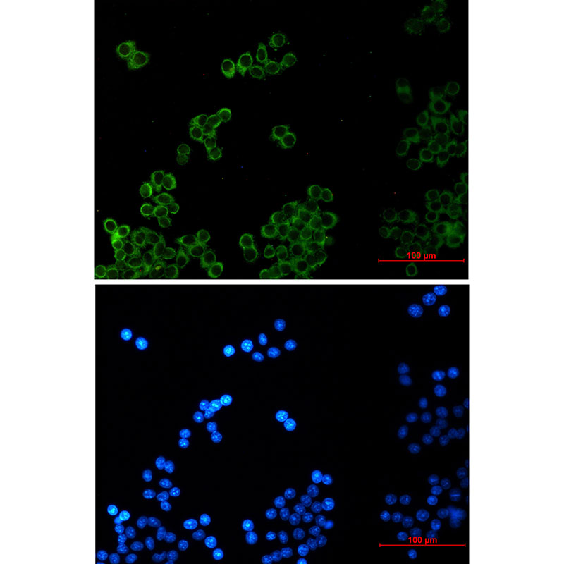 Phospholipase A2 Activator Protein Rabbit mAb ABZ1742