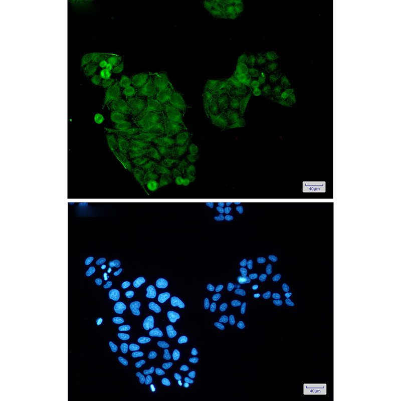 AKT Rabbit mAb ABZ1743