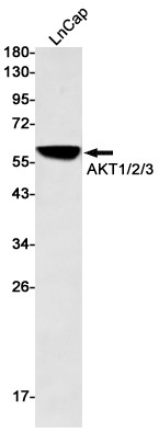 AKT Rabbit mAb ABZ1743