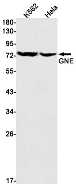 GNE Rabbit mAb ABZ1744