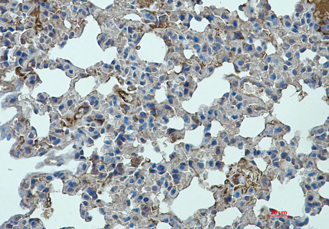STAT2 Rabbit mAb ABZ1745