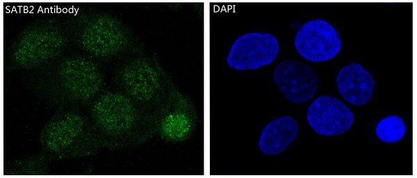 SATB2 Rabbit mAb ABZ1748