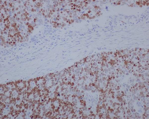 SATB2 Rabbit mAb ABZ1748