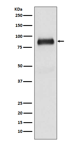 SATB2 Rabbit mAb ABZ1748