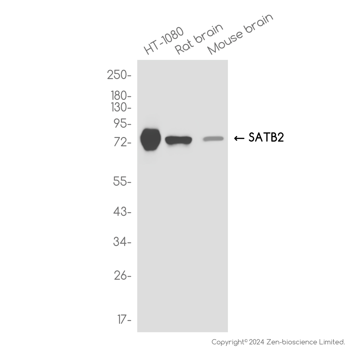 SATB2 Rabbit mAb ABZ1748