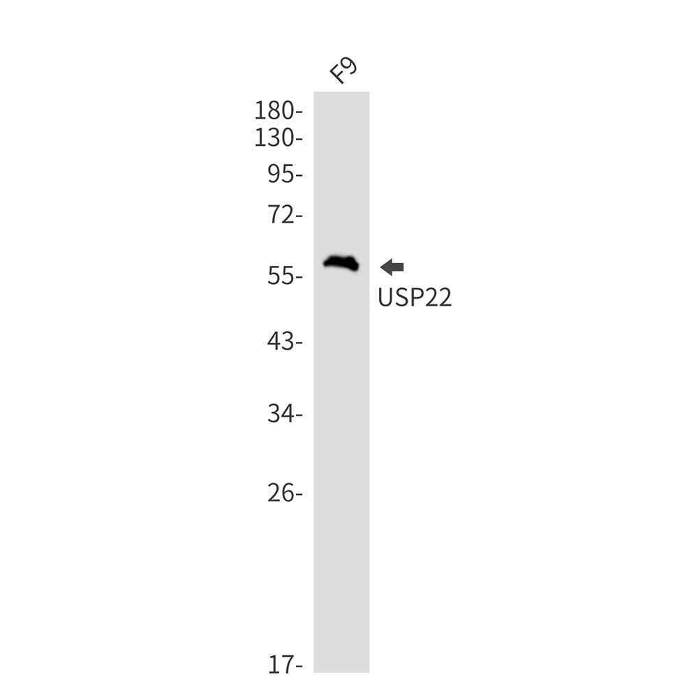 USP22 Rabbit mAb ABZ1749