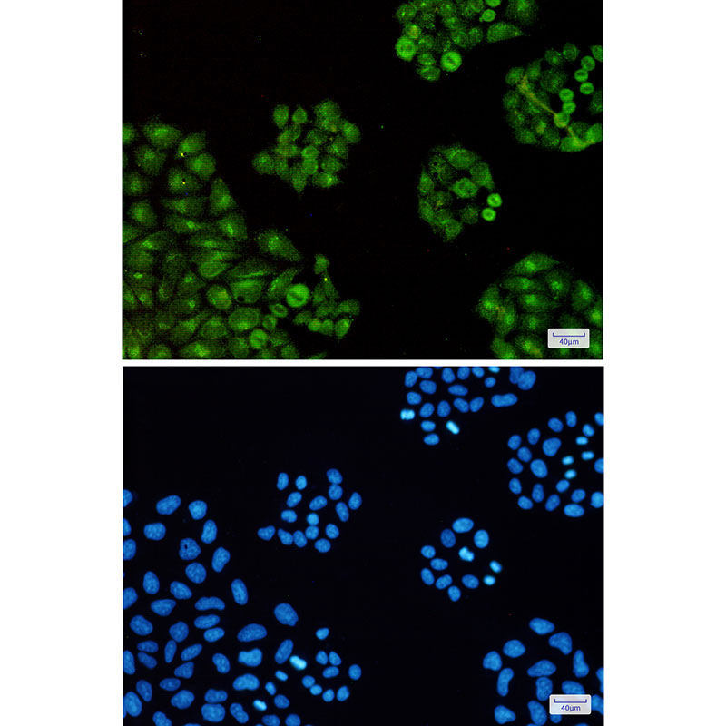 Transcription Termination Factor 2/TTF2 Rabbit mAb ABZ1750