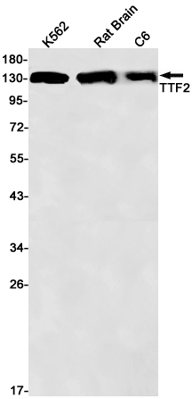 Transcription Termination Factor 2/TTF2 Rabbit mAb ABZ1750