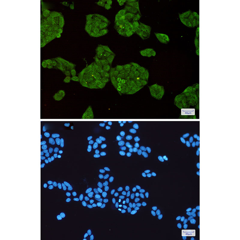STUB1 Rabbit mAb ABZ1752