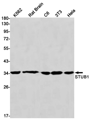 STUB1 Rabbit mAb ABZ1752