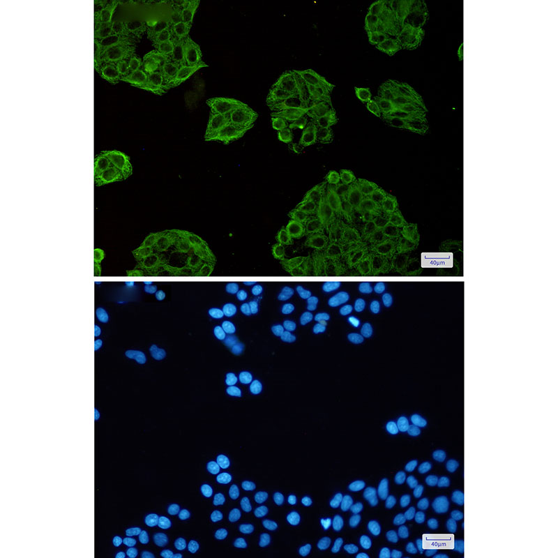 VPS4A Rabbit mAb ABZ1753
