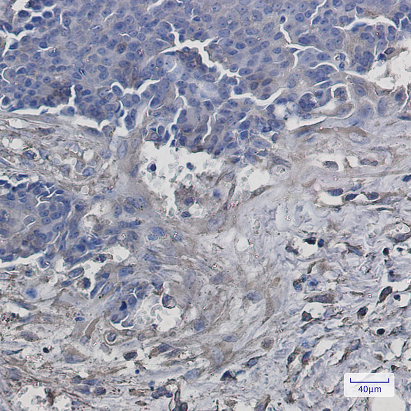 VPS4A Rabbit mAb ABZ1753