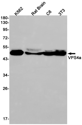 VPS4A Rabbit mAb ABZ1753