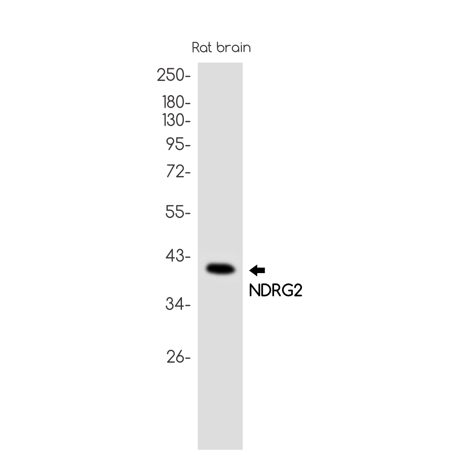 NDRG2 Rabbit mAb ABZ1754
