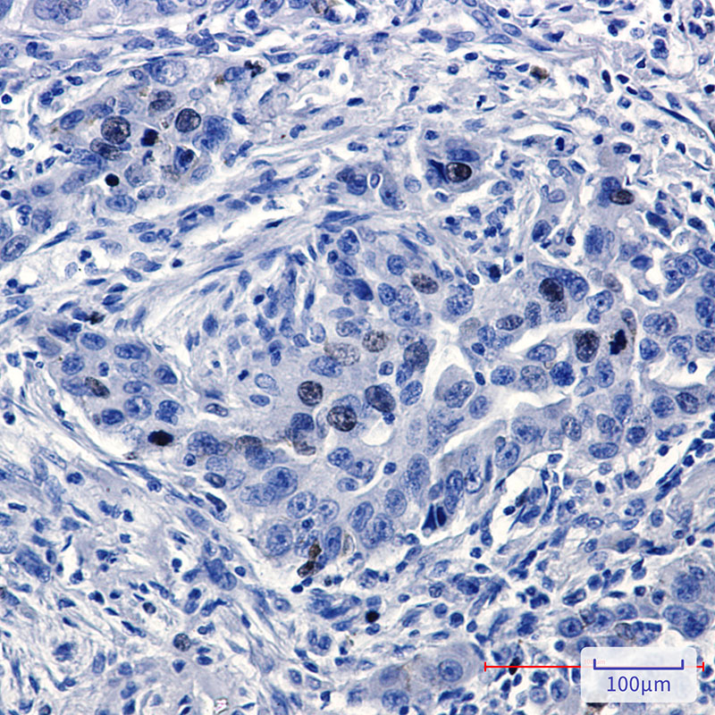 TPX2 Rabbit mAb ABZ1756