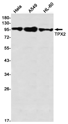 TPX2 Rabbit mAb ABZ1756